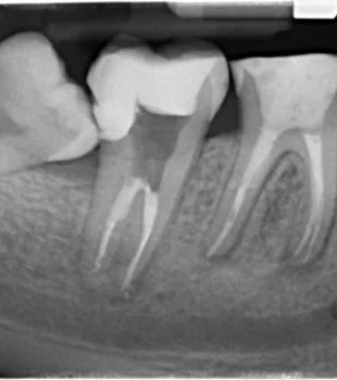 Curs de imagistica dentara digitala 31.03.2012 - 08.04.2012 / WorkShop