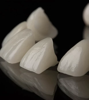Skyn-urile sunt fatete sau coroane dentare din ceramica care imita perfect dintii naturali