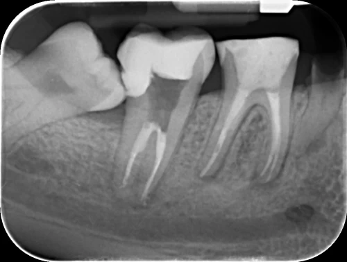 Curs de imagistica dentara digitala 31.03.2012 - 08.04.2012 / WorkShop