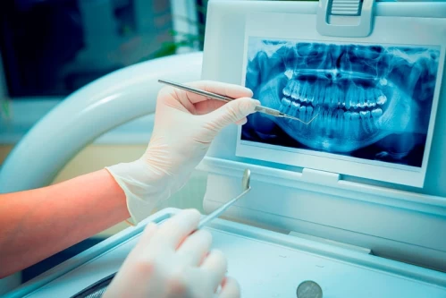 Radiografia dentara este periculoasa ?