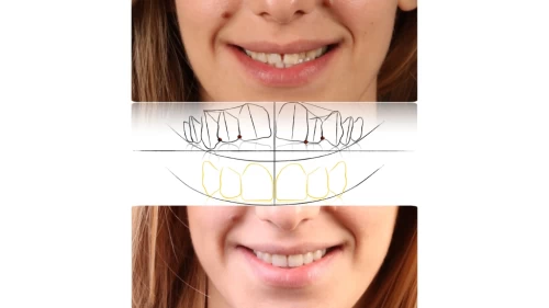 Servicii de estetica dentara la Neoclinique