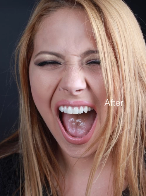 Estetica dentara de cea mai inalta clasa la Neoclinique
