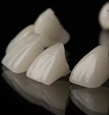 Skyn-urile sunt fatete sau coroane dentare din ceramica care imita perfect dintii naturali