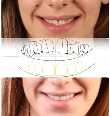 Servicii de estetica dentara la Neoclinique