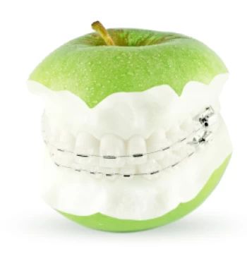 Cand se incepe la copii tratamentul ortodontic?